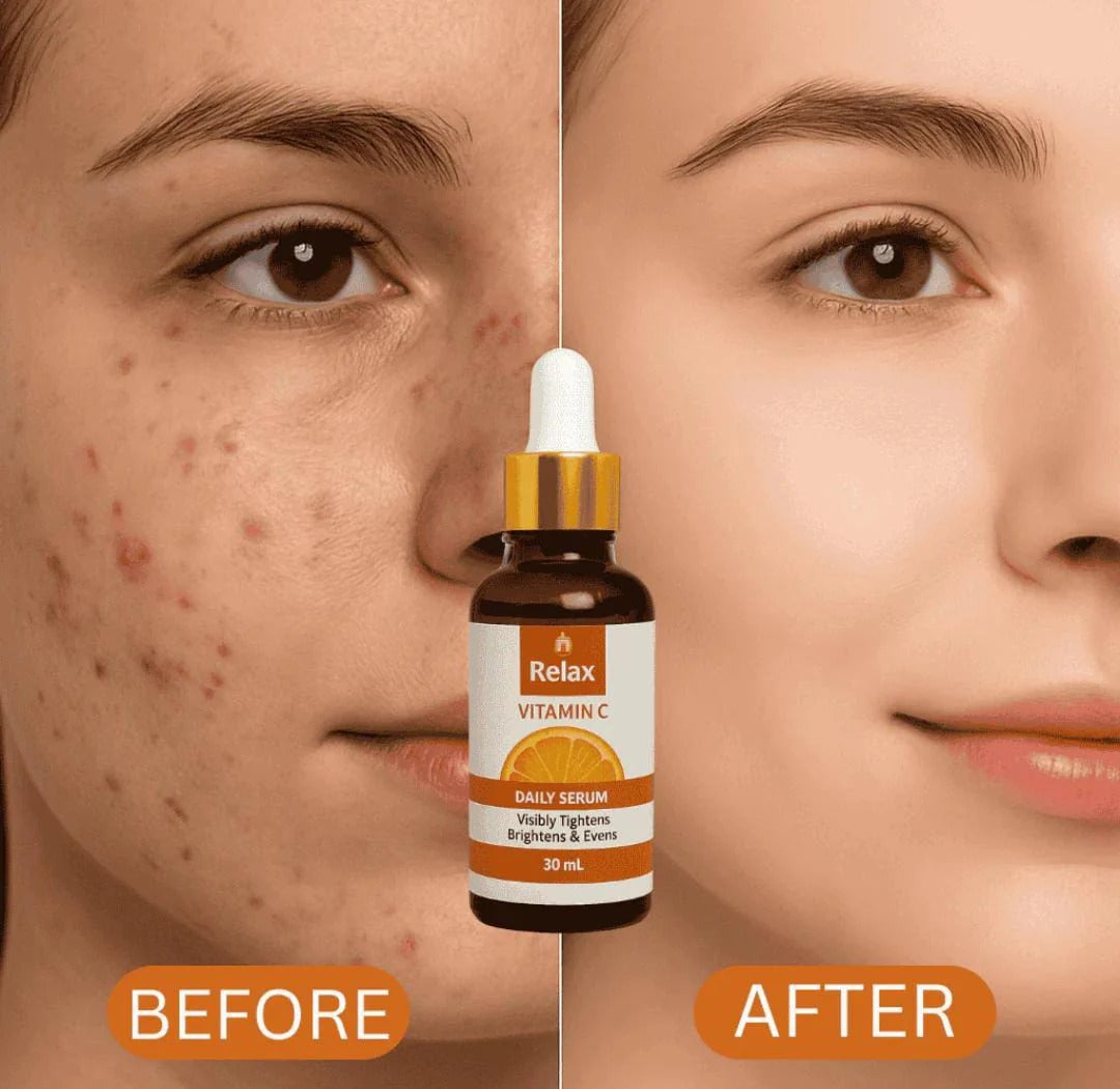 RelaxVitaminCDailyFaceSerum_Brightening_Anti-Aging_HydratingFormulaForHealthyRadiantSkin_30ml_2